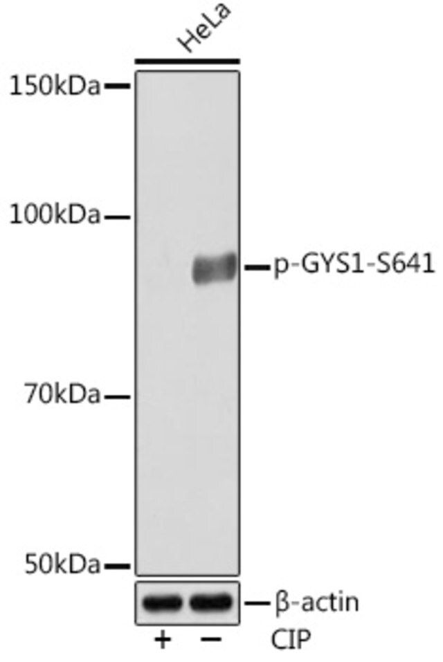 Anti-Phospho-GYS1-S641 antibody produced in rabbit