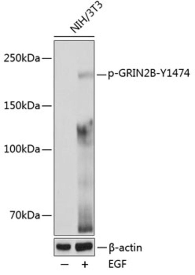 Anti-Phospho-GRIN2B-Y1474 antibody produced in rabbit