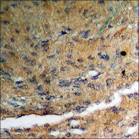 Anti-phospho-GABA-RB (pSer<sup>434</sup>) antibody produced in rabbit