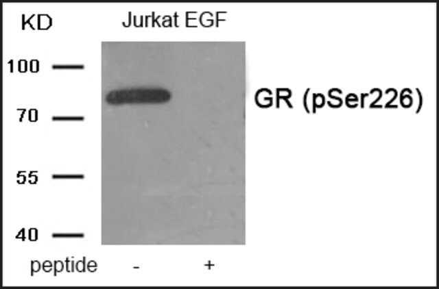 Anti-phospho-GR (pSer<sup>226</sup>) antibody produced in rabbit