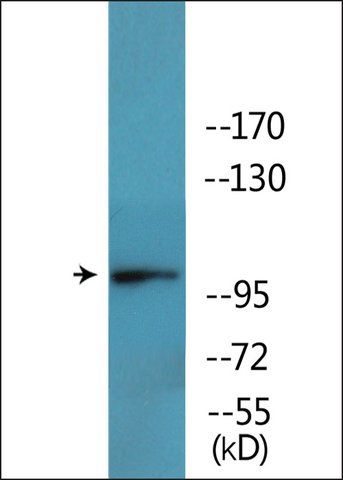 Anti-phospho-GluR2 (pSer<sup>880</sup>) antibody produced in rabbit