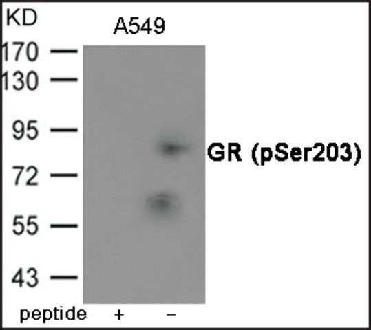 Anti-phospho-GR (pSer<sup>203</sup>) antibody produced in rabbit