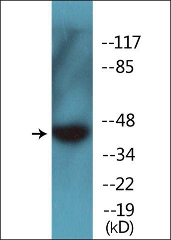 Anti-phospho-GIRK1/KIR3.1/KCNJ3 (pSer<sup>185</sup>) antibody produced in rabbit