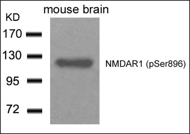 Anti-phospho-GRIN1 (pSer<sup>896</sup>) antibody produced in rabbit