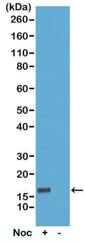 Anti-Phospho-Histone H3 (Thr6) antibody, Rabbit monoclonal