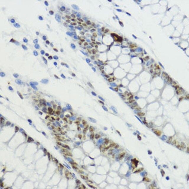 Anti-Phospho-Histone H3-T6 antibody produced in rabbit