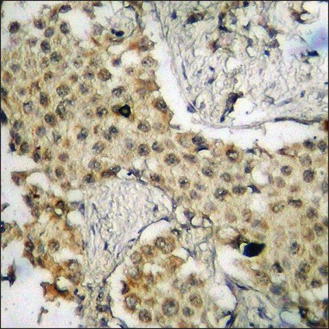 Anti-phospho-HSL (pSer<sup>552</sup>) antibody produced in rabbit