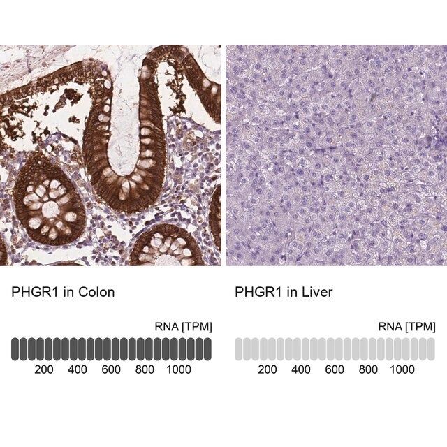 Anti-PHGR1 antibody produced in rabbit