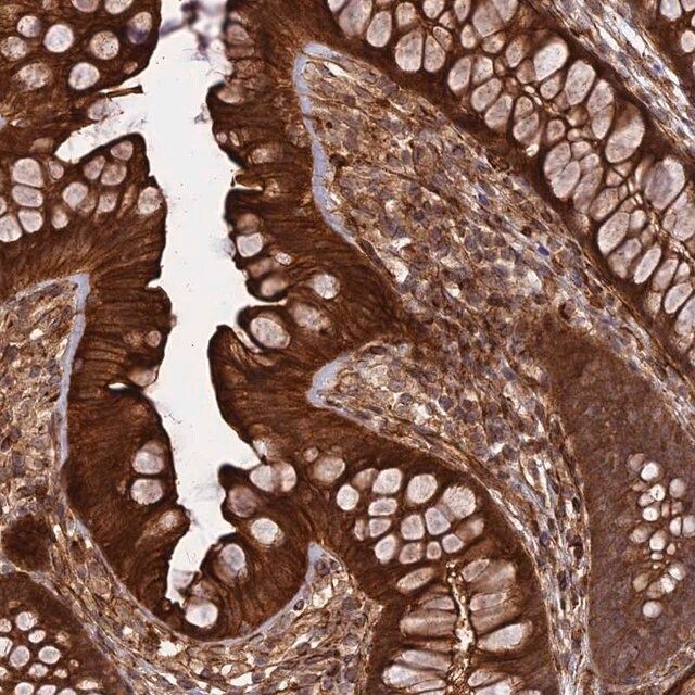 Anti-PHLDB3 antibody produced in rabbit