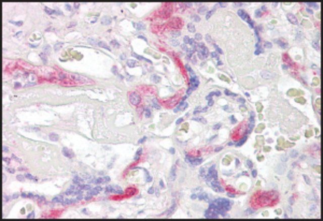 Anti-PHLDA2 (C-terminal) antibody produced in goat