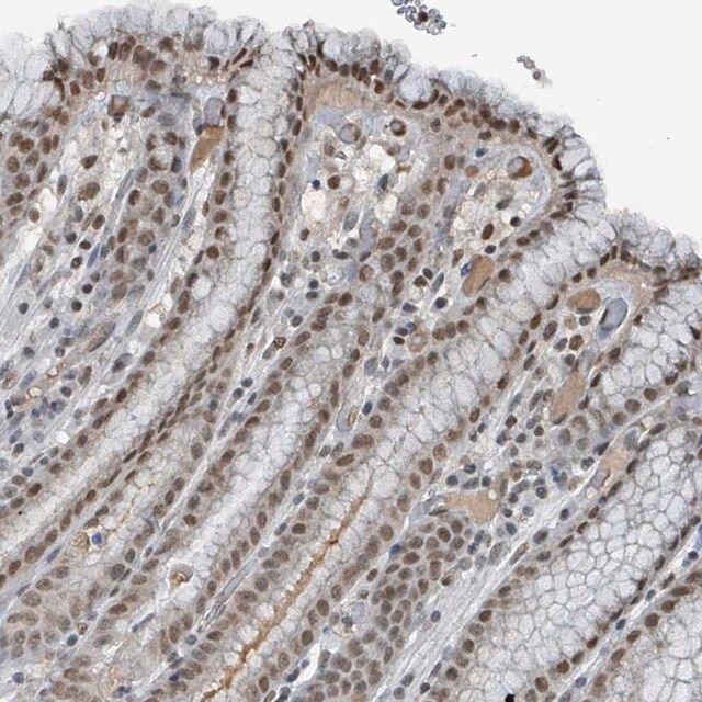 Anti-PHIP antibody produced in rabbit