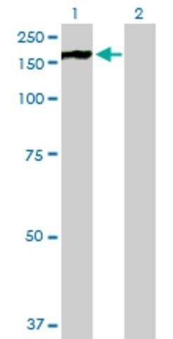 Anti-PHKA2 antibody produced in mouse