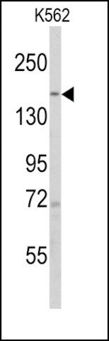 Anti-PHLPP1 (N-term) antibody produced in rabbit