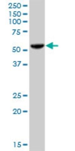 Anti-PHGDH antibody produced in mouse