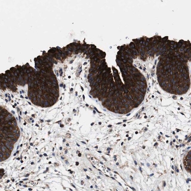 Anti-PHLPP1 antibody produced in rabbit