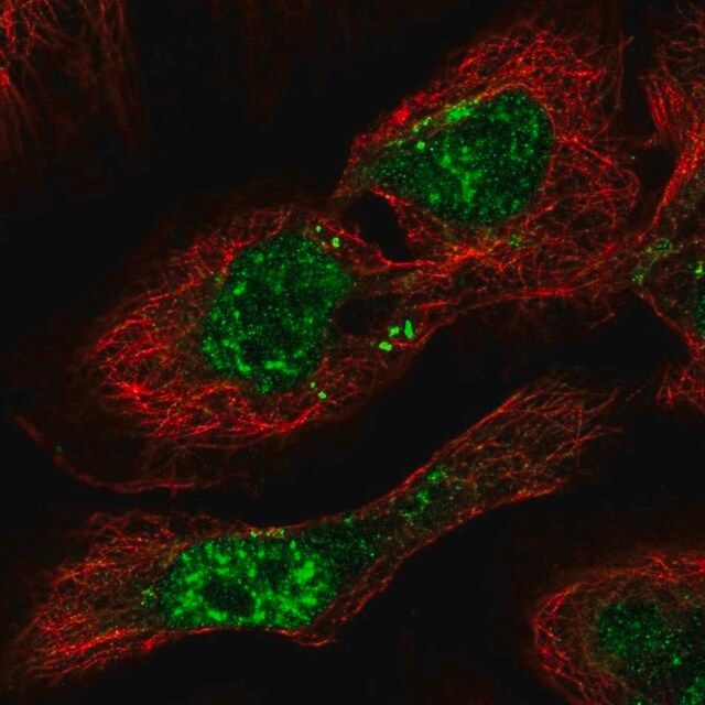 Anti-PHF7 antibody produced in rabbit