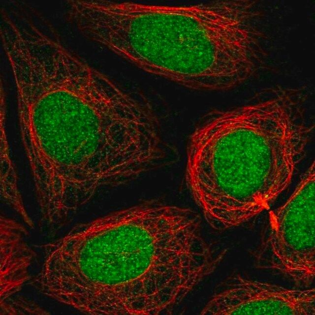 Anti-PHF8 antibody produced in rabbit