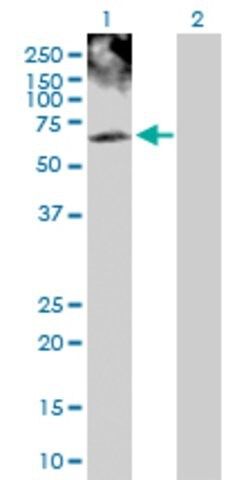 Anti-PHKG2 antibody produced in rabbit