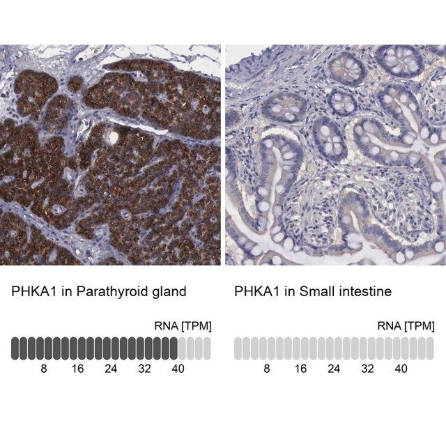 Anti-PHKA1 antibody produced in rabbit