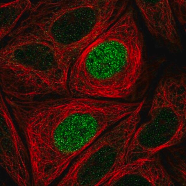 Anti-PHLDB1 antibody produced in rabbit