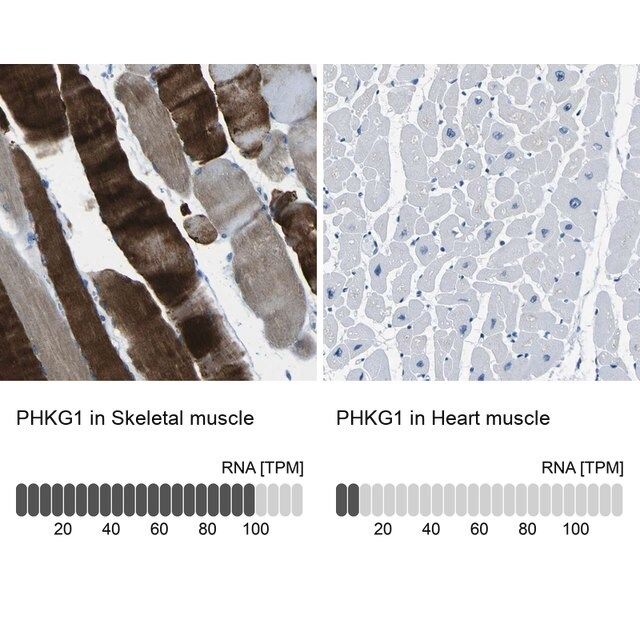 Anti-PHKG1 antibody produced in rabbit