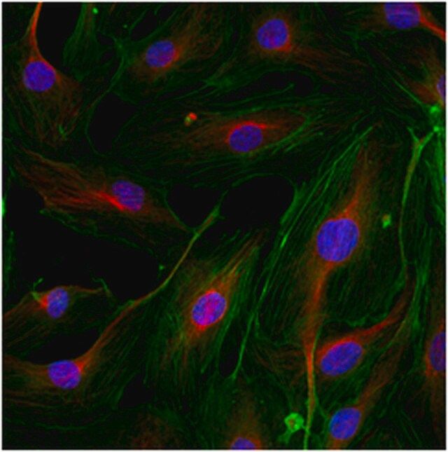 Anti-PHLPP2 Antibody