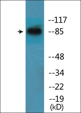 Anti-phospho-Catenin- (pTyr<sup>654</sup>) antibody produced in rabbit