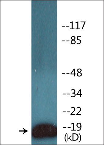 Anti-phospho-CD3  (pTyr<sup>142</sup>) antibody produced in rabbit