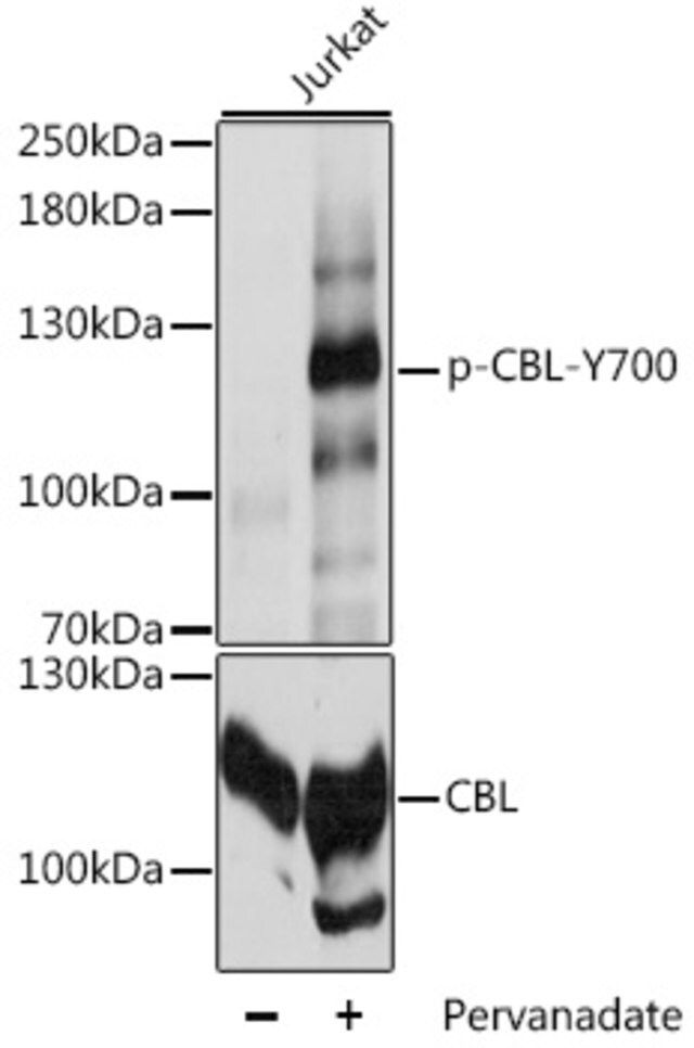 Anti-Phospho-CBL-Y700 antibody produced in rabbit