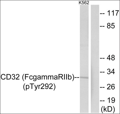 Anti-phospho-CD32 (pTyr<sup>292</sup>) antibody produced in rabbit