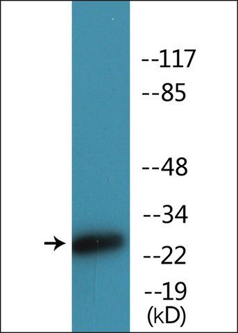 Anti-phospho-CD28 (pTyr<sup>218</sup>) antibody produced in rabbit