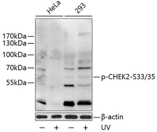 Anti-Phospho-CHEK2-S33/35 antibody produced in rabbit