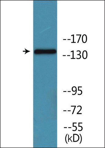 Anti-phospho-CD171/N-CAML1 (pSer<sup>1181</sup>) antibody produced in rabbit