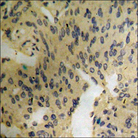 Anti-phospho-Catenin- (pTyr<sup>489</sup>) antibody produced in rabbit