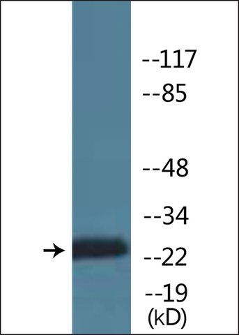 Anti-phospho-CKII- (pSer<sup>209</sup>) antibody produced in rabbit