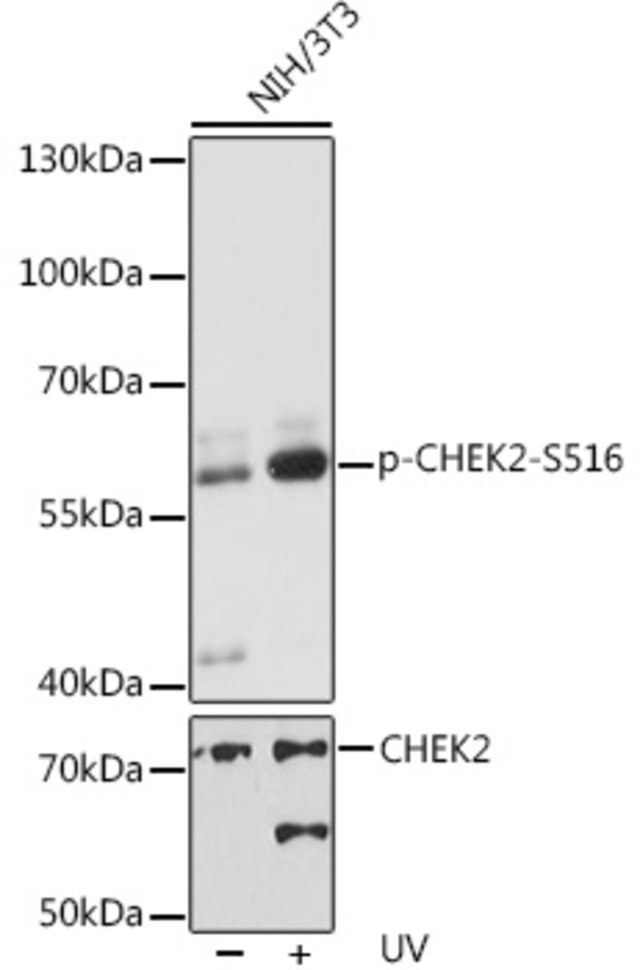 Anti-Phospho-CHEK2-S516 antibody produced in rabbit