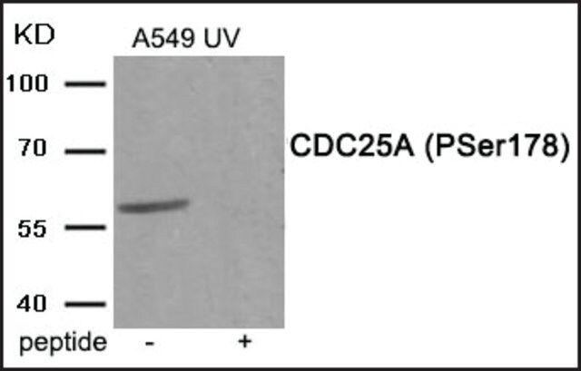 Anti-phospho-CDC25A (pSer<sup>178</sup>) antibody produced in rabbit