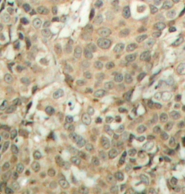 Anti-Phospho-CFL1-S3 antibody produced in rabbit