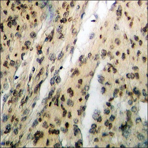 Anti-phospho-Chk1 (pSer<sup>317</sup>) antibody produced in rabbit