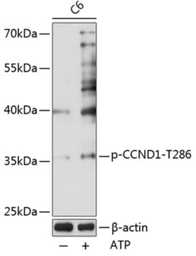 Anti-Phospho-CCND1-T286 antibody produced in rabbit