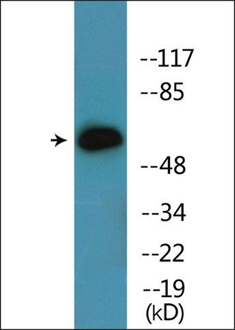 Anti-phospho-Chk2 (pSer<sup>516</sup>) antibody produced in rabbit