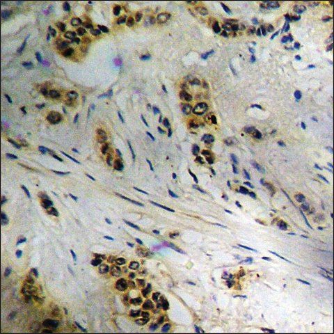 Anti-phospho-CDC37 (pSer<sup>13</sup>) antibody produced in rabbit