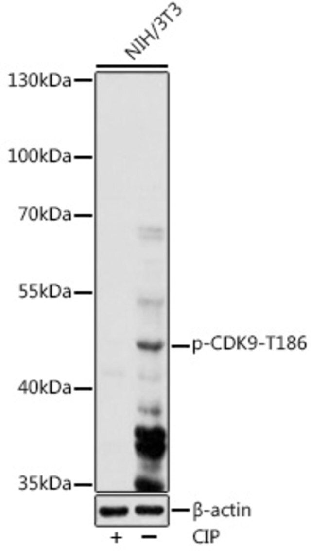 Anti-Phospho-CDK9-T186 antibody produced in rabbit