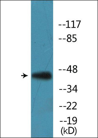 Anti-phospho-CCR5 (pSer<sup>336</sup>) antibody produced in rabbit