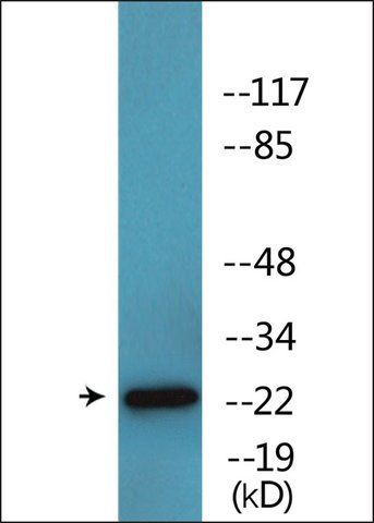 Anti-phospho-Claudin 6 (pTyr<sup>219</sup>) antibody produced in rabbit