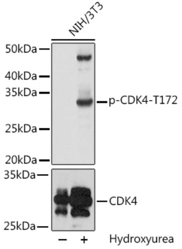 Anti-Phospho-CDK4-T172 antibody produced in rabbit