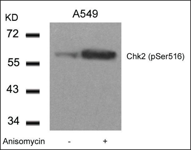 Anti-phospho-CHEK2 (pSer<sup>516</sup>) antibody produced in rabbit