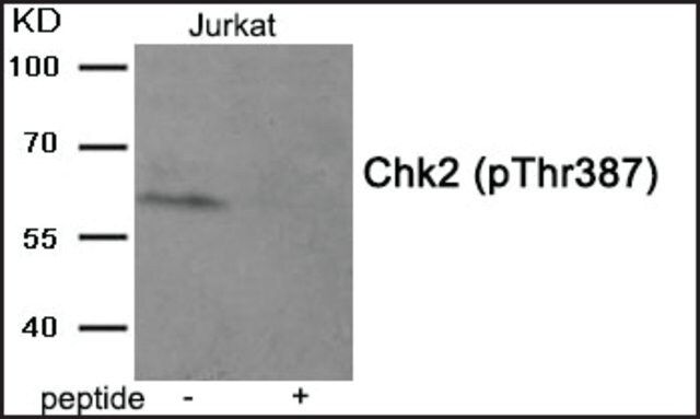 Anti-phospho-Chk2 (pThr<sup>387</sup>) antibody produced in rabbit