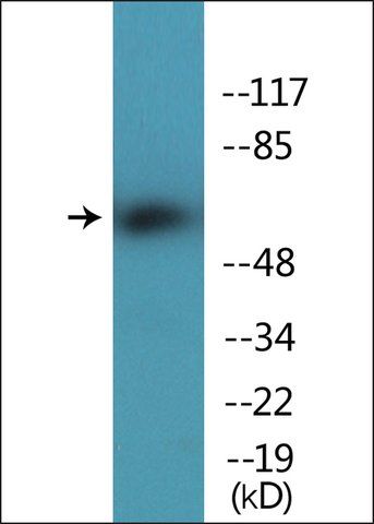 Anti-phospho-Chk2 (pThr<sup>387</sup>) antibody produced in rabbit