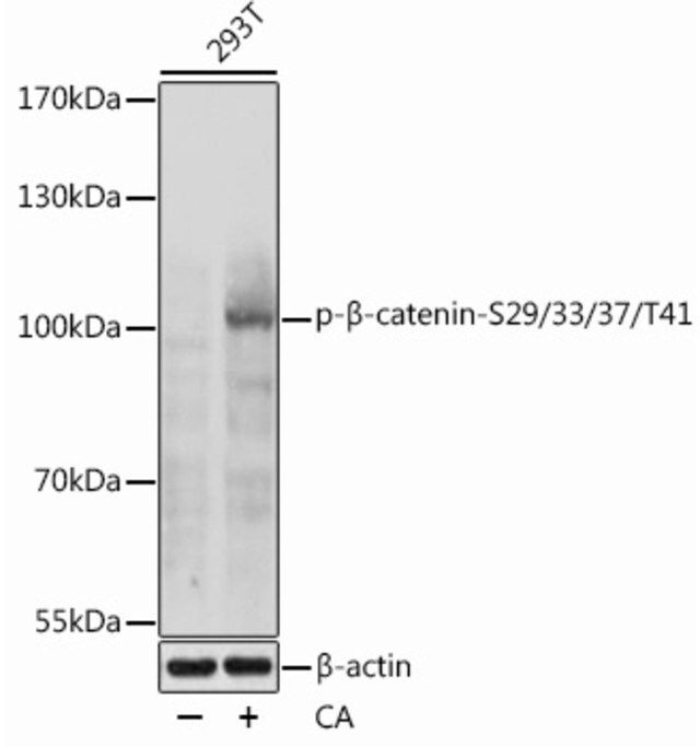 Anti-Phospho-CTNNB1-S29/33/37/T41 antibody produced in rabbit